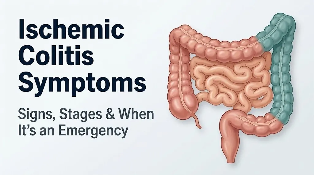 Ischemic colitis symptoms